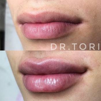 Фото с портфолио Виктория Кузнецова 