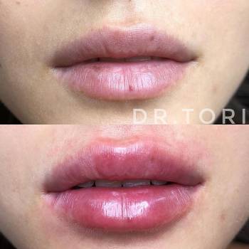 Фото с портфолио Виктория Кузнецова 