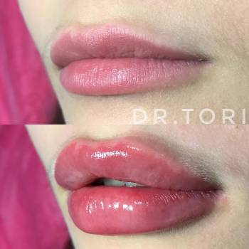 Фото с портфолио Виктория Кузнецова 