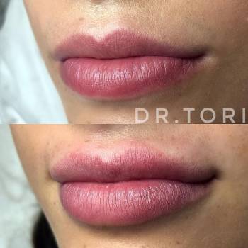 Фото с портфолио Виктория Кузнецова 