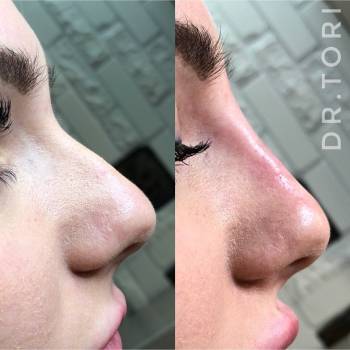 Фото с портфолио Виктория Кузнецова 