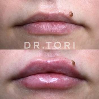 Фото с портфолио Виктория Кузнецова 