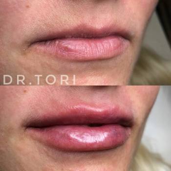 Фото с портфолио Виктория Кузнецова 