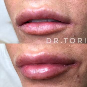 Фото с портфолио Виктория Кузнецова 