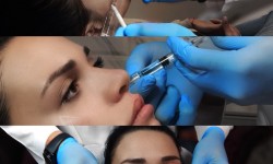 Модельные скулы Косметолог Константин Київ