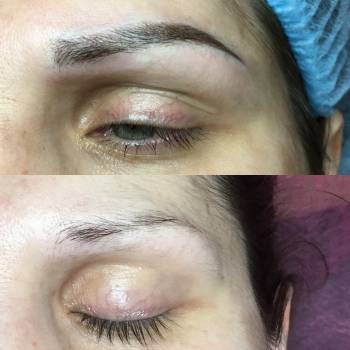 Микроблейдинг