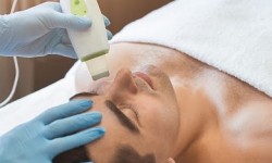 Чистка лица, Hydrofacial, ультразвуковая, механическая чистка Косметолог-естетист Влада Харків