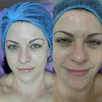 МассажPro, Днепр Фото - 10