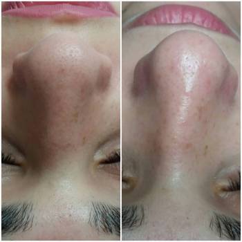 Фото с портфолио Тина Цицилина 