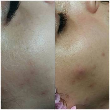 Фото с портфолио Тина Цицилина 