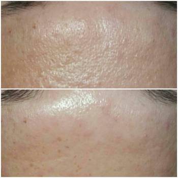 Фото с портфолио Тина Цицилина 