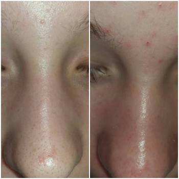 Фото с портфолио Тина Цицилина 