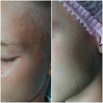 Фото с портфолио Тина Цицилина 