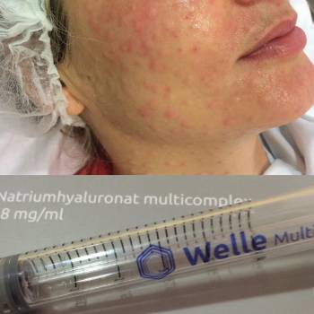 Фото с портфолио Флора Мхитарян 