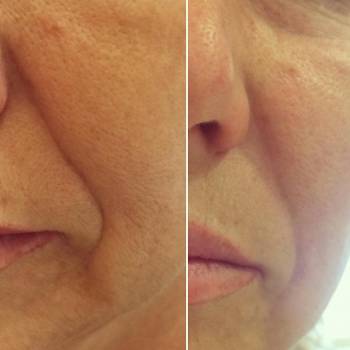 Фото с портфолио Флора Мхитарян 