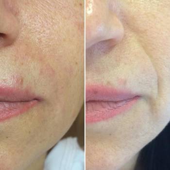 Фото с портфолио Флора Мхитарян 