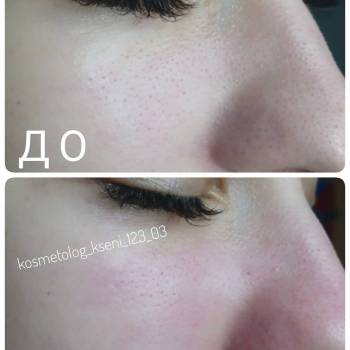 Фото с портфолио Ксения 