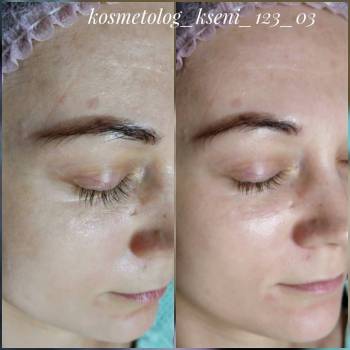 Фото с портфолио Ксения 