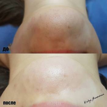 Екатерина , Херсон Фото - 6