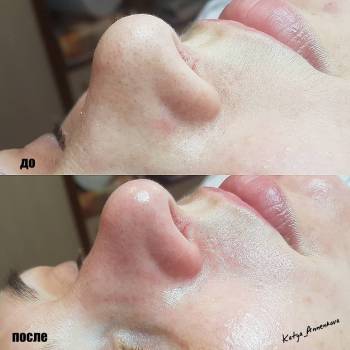 Екатерина , Херсон Фото - 7