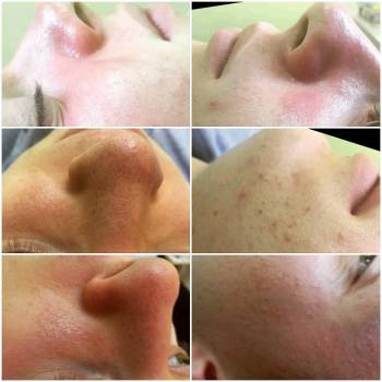 Фото с портфолио Ирина Веселая 