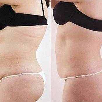 Новый препарат от Испанских медиков, который корректирует фи