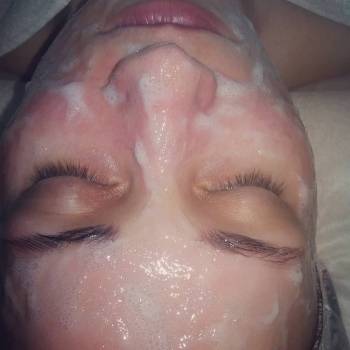 Карбокситерапия-поверенный метод омоложения и профилактики с