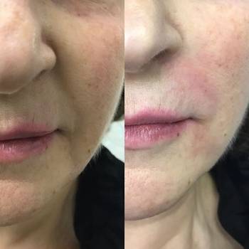 Фото с портфолио Ирина Пугач 