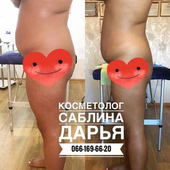 Дарья Саблина , Одеса Фото - 5