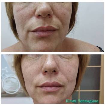 Юлия Лепендина , Одеса Фото - 5