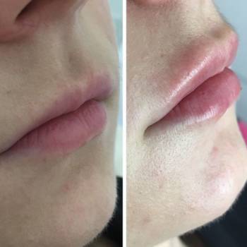 Фото с портфолио Юлия 