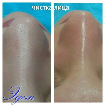 Эдем, Харьков Фото - 11