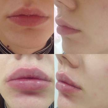 Юлия Смол , Харьков Фото - 7