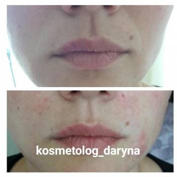 Фото с портфолио Дарина 