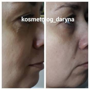 Фото с портфолио Дарина 