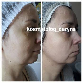 Фото с портфолио Дарина 