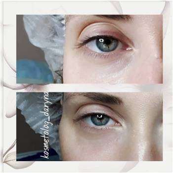 Фото с портфолио Дарина 