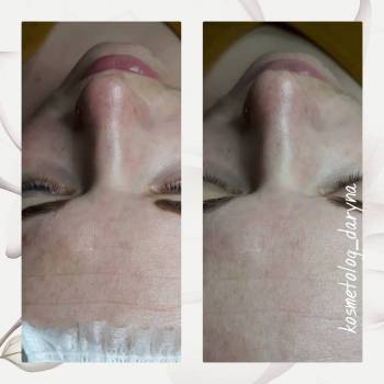 Фото с портфолио Дарина 