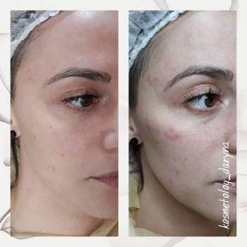 Фото с портфолио Дарина 