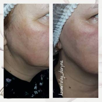 Фото с портфолио Дарина 