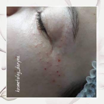 Фото с портфолио Дарина 