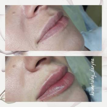 Фото с портфолио Дарина 