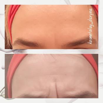 Фото с портфолио Дарина 