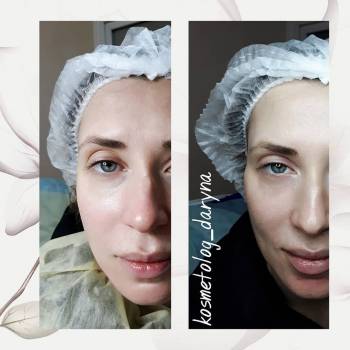 Фото с портфолио Дарина 