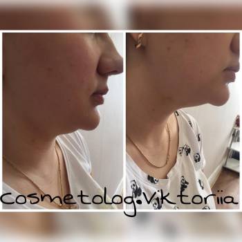 Фото с портфолио Рютина Виктория 