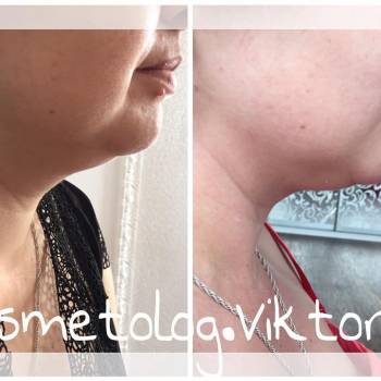 Фото с портфолио Рютина Виктория 