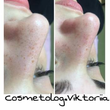 Фото с портфолио Рютина Виктория 