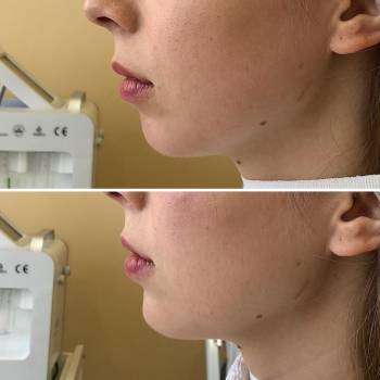 Алена Туманцова , Харьков Фото - 6