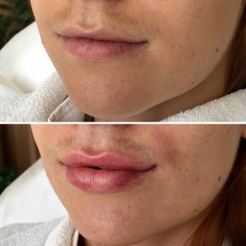 Алена Туманцова , Харьков Фото - 17