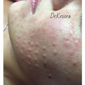 Фото с портфолио Алена Кесиора 